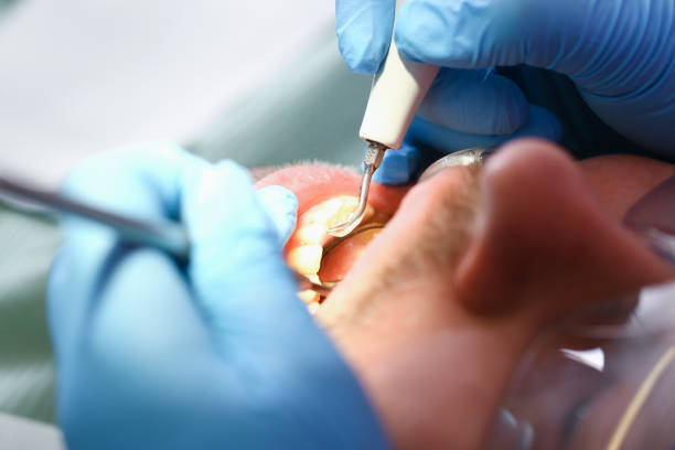 Best Dental Abscess Treatment in Rosamond, CA