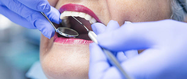 Best Emergency Root Canal Therapy in Rosamond, CA